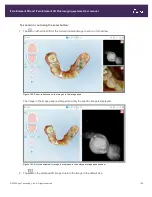 Preview for 197 page of Align Technology iTero Element 5D User Manual