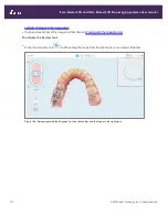 Preview for 200 page of Align Technology iTero Element 5D User Manual