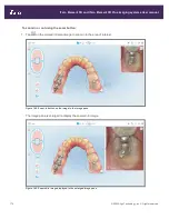 Preview for 202 page of Align Technology iTero Element 5D User Manual