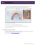 Preview for 204 page of Align Technology iTero Element 5D User Manual