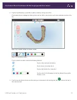 Preview for 207 page of Align Technology iTero Element 5D User Manual