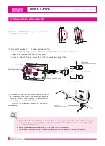 Preview for 10 page of Alkamedi AMS4000 Operation Manual