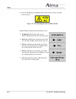 Предварительный просмотр 24 страницы Alma Lasers Accent xl Operator'S Manual