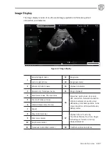 Preview for 31 page of Alpinion Medical Systems X-CUBE 70 Quick Manual