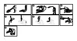 Preview for 6 page of Ambu AuraOnce Disposable Laryngeal Mask Instructions For Use Manual