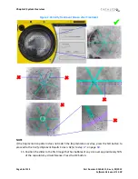 Preview for 48 page of AMO Catalys OptiMedica Operator'S Manual