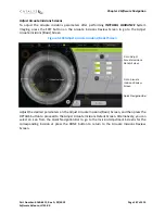 Preview for 147 page of AMO Catalys OptiMedica Operator'S Manual