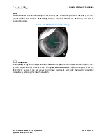 Preview for 153 page of AMO Catalys OptiMedica Operator'S Manual