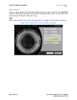 Preview for 158 page of AMO Catalys OptiMedica Operator'S Manual