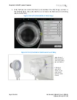 Preview for 192 page of AMO Catalys OptiMedica Operator'S Manual