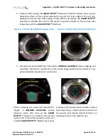 Preview for 297 page of AMO Catalys OptiMedica Operator'S Manual