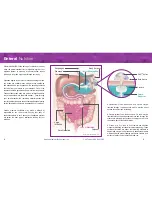 Предварительный просмотр 3 страницы AMT G-JET Button Patient Education Manual