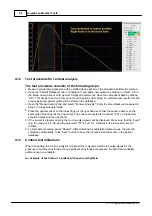 Предварительный просмотр 32 страницы Angioscan Electronics AngioScan-01 User Manual