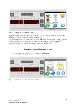 Предварительный просмотр 21 страницы Arcomed Volumed uVP7000 Premium User Manual