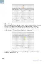 Предварительный просмотр 58 страницы Arjo HUNTLEIGH FTS-3 Instructions For Use Manual