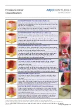 Preview for 49 page of Arjohuntleigh Aura Seat Cushion Manual