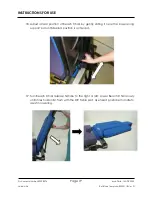 Preview for 19 page of Arthrex Lift-Assist AR-1627 Instructions For Use Manual