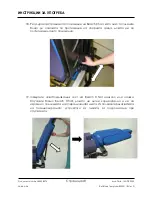 Preview for 48 page of Arthrex Lift-Assist AR-1627 Instructions For Use Manual