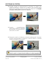 Preview for 50 page of Arthrex Lift-Assist AR-1627 Instructions For Use Manual