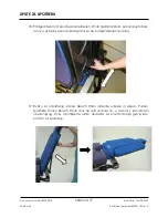 Preview for 77 page of Arthrex Lift-Assist AR-1627 Instructions For Use Manual