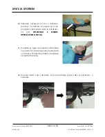 Preview for 78 page of Arthrex Lift-Assist AR-1627 Instructions For Use Manual