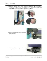 Preview for 103 page of Arthrex Lift-Assist AR-1627 Instructions For Use Manual