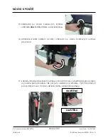 Preview for 105 page of Arthrex Lift-Assist AR-1627 Instructions For Use Manual