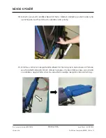 Preview for 106 page of Arthrex Lift-Assist AR-1627 Instructions For Use Manual