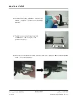 Preview for 109 page of Arthrex Lift-Assist AR-1627 Instructions For Use Manual