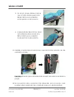 Preview for 111 page of Arthrex Lift-Assist AR-1627 Instructions For Use Manual