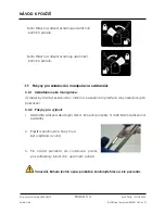 Preview for 113 page of Arthrex Lift-Assist AR-1627 Instructions For Use Manual