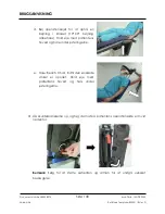 Preview for 140 page of Arthrex Lift-Assist AR-1627 Instructions For Use Manual