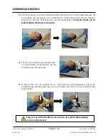 Preview for 166 page of Arthrex Lift-Assist AR-1627 Instructions For Use Manual