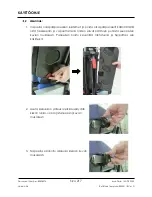 Preview for 217 page of Arthrex Lift-Assist AR-1627 Instructions For Use Manual