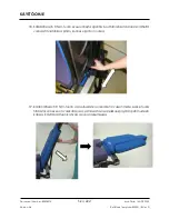 Preview for 222 page of Arthrex Lift-Assist AR-1627 Instructions For Use Manual