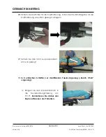 Preview for 285 page of Arthrex Lift-Assist AR-1627 Instructions For Use Manual