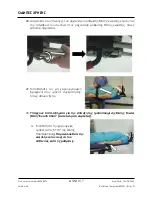 Preview for 317 page of Arthrex Lift-Assist AR-1627 Instructions For Use Manual