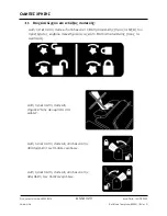 Preview for 320 page of Arthrex Lift-Assist AR-1627 Instructions For Use Manual