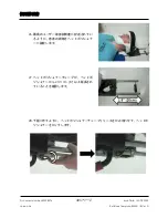 Preview for 405 page of Arthrex Lift-Assist AR-1627 Instructions For Use Manual