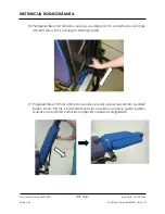 Preview for 431 page of Arthrex Lift-Assist AR-1627 Instructions For Use Manual