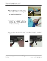 Preview for 432 page of Arthrex Lift-Assist AR-1627 Instructions For Use Manual