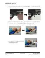 Preview for 520 page of Arthrex Lift-Assist AR-1627 Instructions For Use Manual