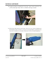 Preview for 669 page of Arthrex Lift-Assist AR-1627 Instructions For Use Manual