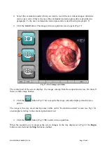 Preview for 17 page of ASCOM DIGISTAT User Manual