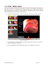 Preview for 37 page of ASCOM DIGISTAT User Manual