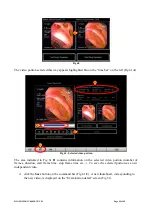 Preview for 43 page of ASCOM DIGISTAT User Manual