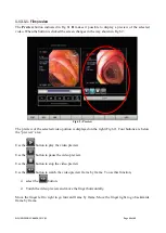 Preview for 44 page of ASCOM DIGISTAT User Manual