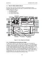 Preview for 35 page of Aspect A-2000 BIS Operating Manual