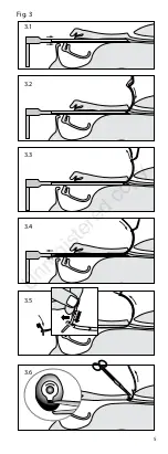 Предварительный просмотр 5 страницы Atos Medical Provox GuideWire Instructions For Use Manual