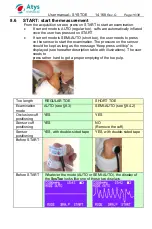 Preview for 17 page of ATYS MEDICAL SysToe User Manual